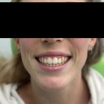 TONI Landing Foto Invisaling Pazienti (1)