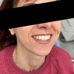 TONI Landing Foto Invisaling Pazienti