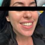 TONI Landing Foto Invisaling Pazienti (1)