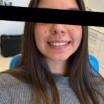 TONI Landing Foto Invisaling Pazienti (1)