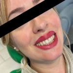 TONI Landing Foto Invisaling Pazienti