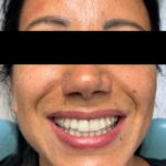 TONI Landing Foto Invisaling Pazienti