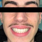 TONI Landing Foto Invisaling Pazienti (1) (1)