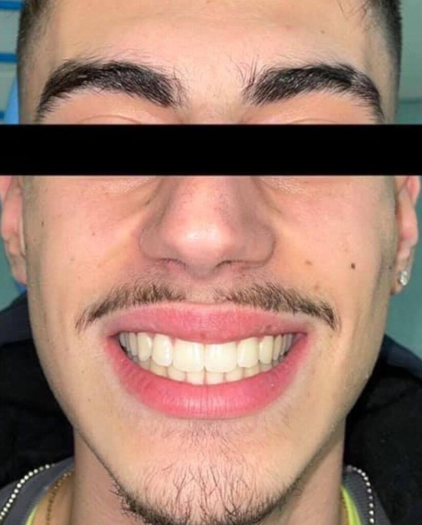 TONI Landing Foto Invisaling Pazienti (1) (1)