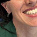 2025_03_Toni-Romaniello-Invisalign-2